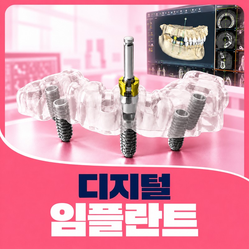 처인구임플란트