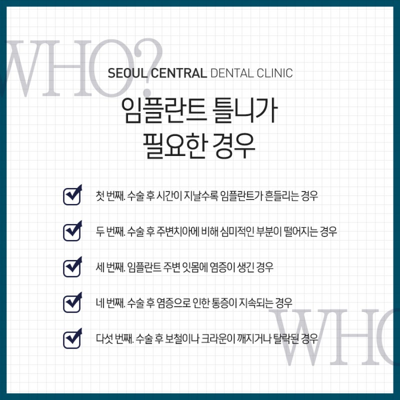 임플란트주의사항