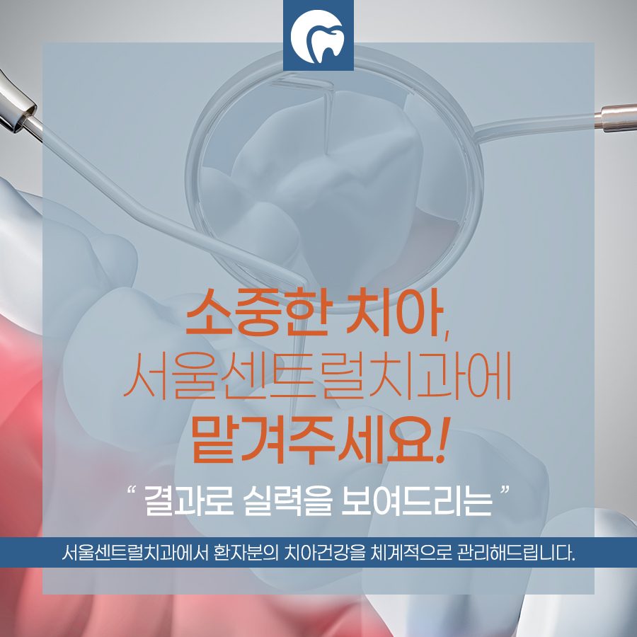 사랑니는 언제 빼고 언제 지켜봐야 하나요 — 처인구사랑니발치 — 서울센트럴치과의원