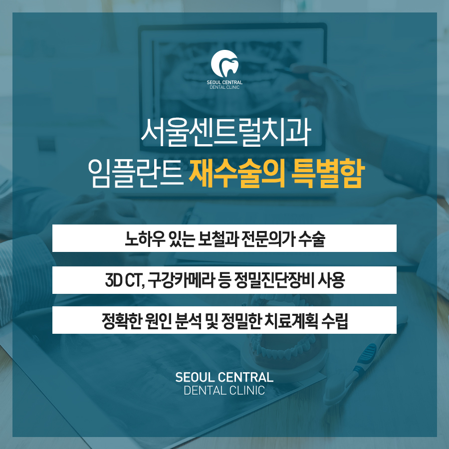 재수술노하우