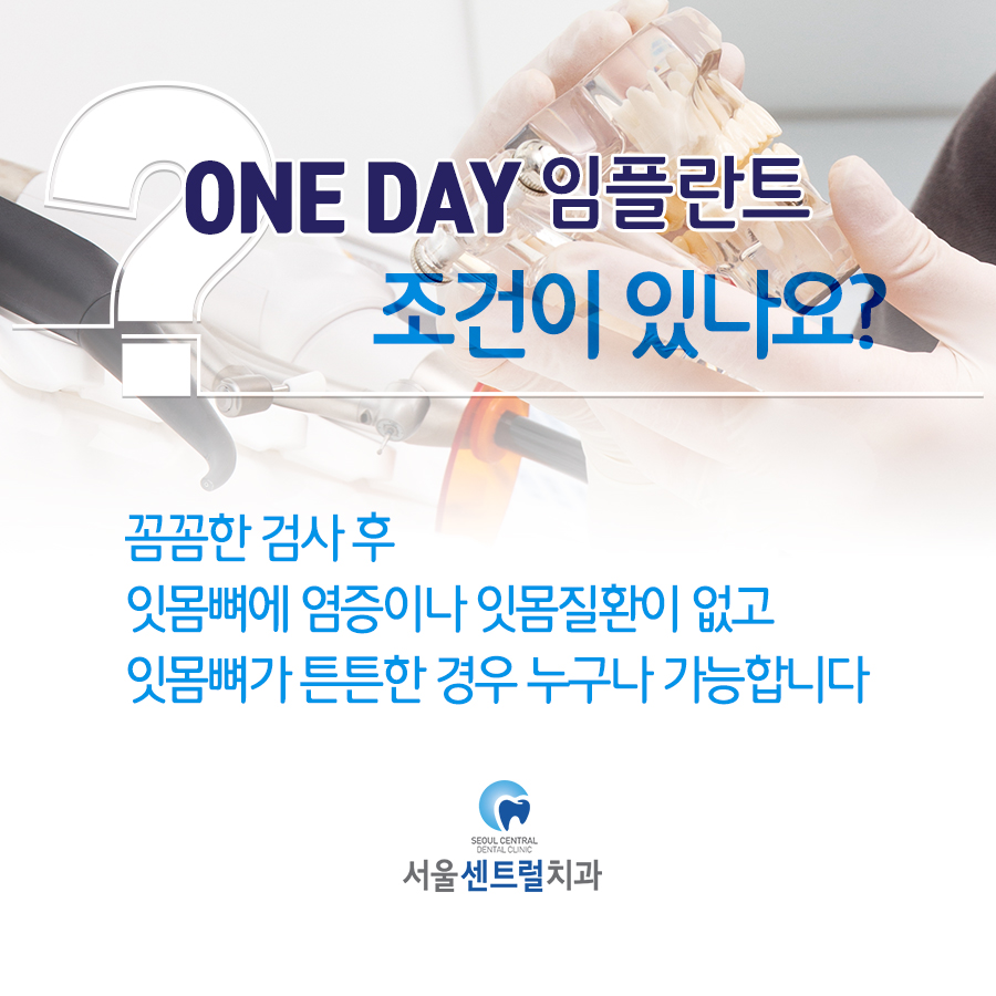 임플란트상담