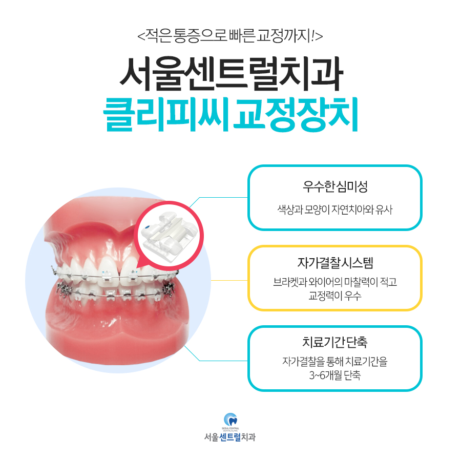 교정장치소개