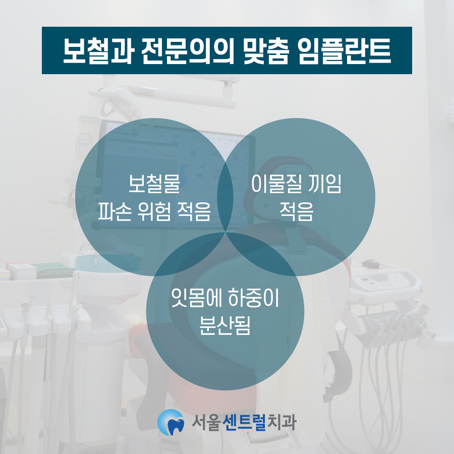 맞춤임플란트